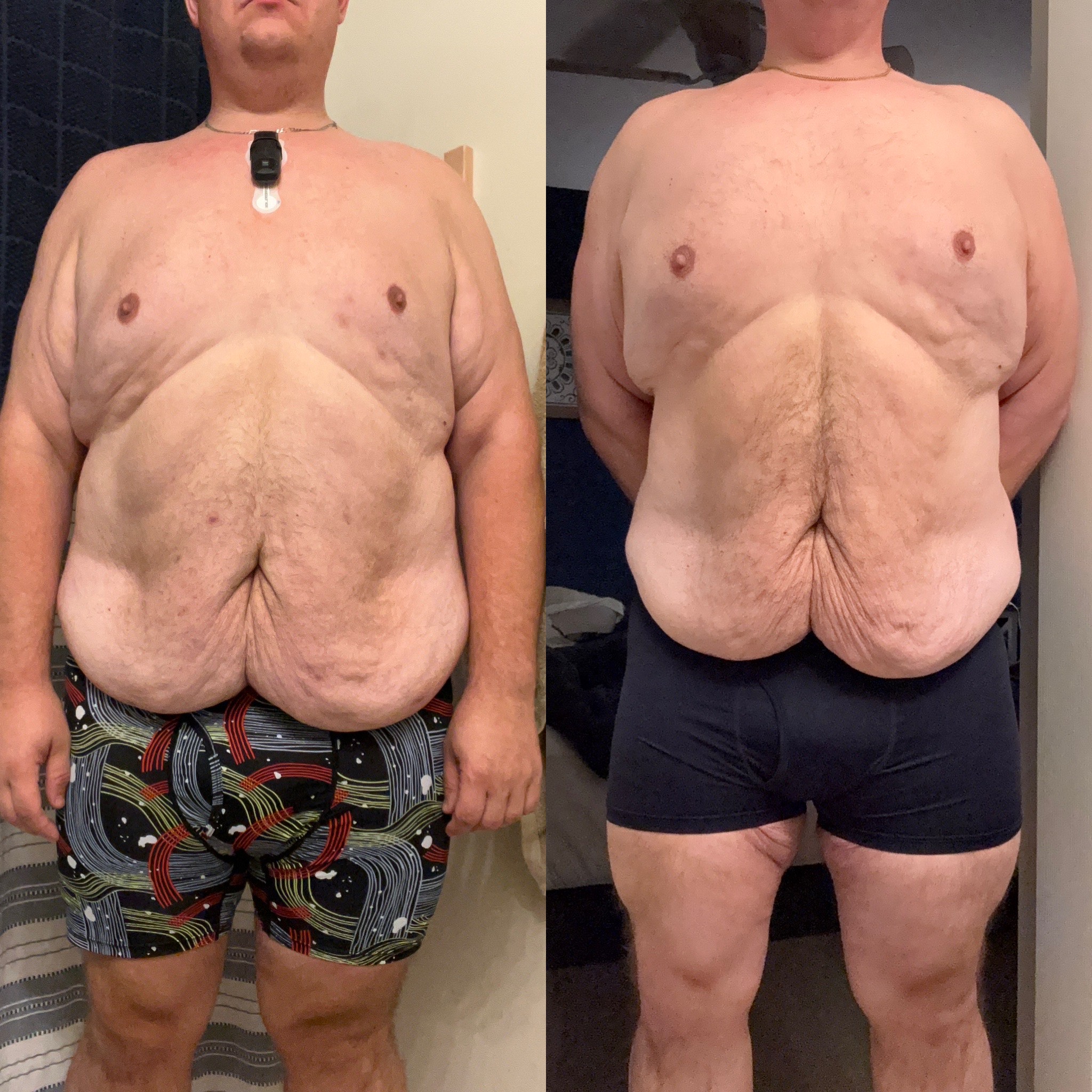 Transfomation 2